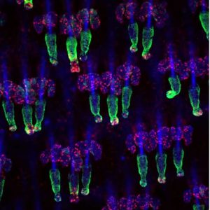 Ósma nagroda: ogon myszy; barwienie pełne, pokazujące komórki macierzyste mieszka włosowego i innych rozmnażających się komórek;
Autor: Yaron Fuchs, Howard Hughes Medical Institute/The Rockefeller University
New York, Nowy Jork, U.S.A.;
Technika: obrazowanie konfokalne.